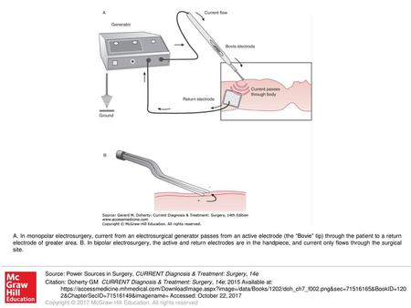 A. In monopolar electrosurgery, current from an electrosurgical generator passes from an active electrode (the “Bovie” tip) through the patient to a return.