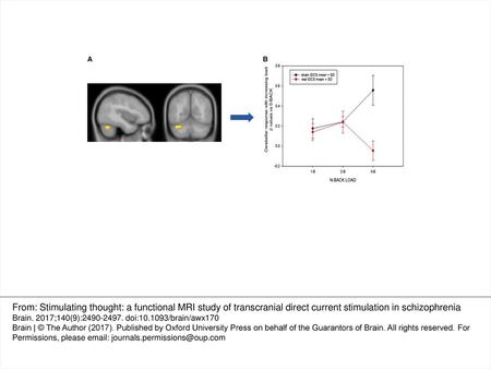 Figure 1 Decrease in neuronal activity during n-back task in real tDCS as compared to sham stimulation. (A) Main effects of group (sham > real) based on.