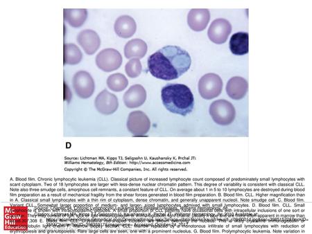 (Used with permission from Lichtman’s Atlas of Hematology, www