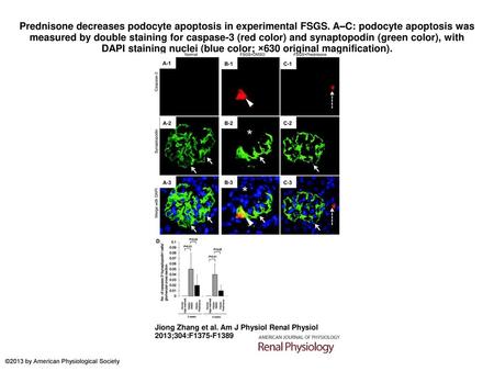 Prednisone decreases podocyte apoptosis in experimental FSGS