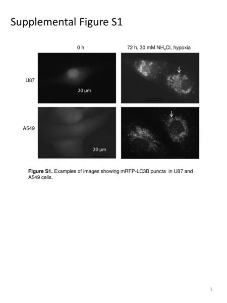 Supplemental Figure S1 Figure S1. Examples of images showing mRFP-LC3B puncta in U87 and A549 cells. U87 72 h, 30 mM NH4Cl, hypoxia 0 h A549 20 μm.
