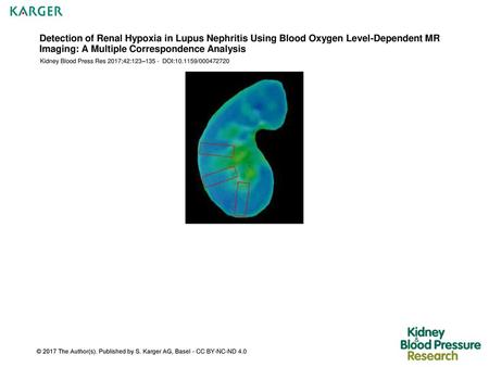 Detection of Renal Hypoxia in Lupus Nephritis Using Blood Oxygen Level-Dependent MR Imaging: A Multiple Correspondence Analysis Kidney Blood Press Res.