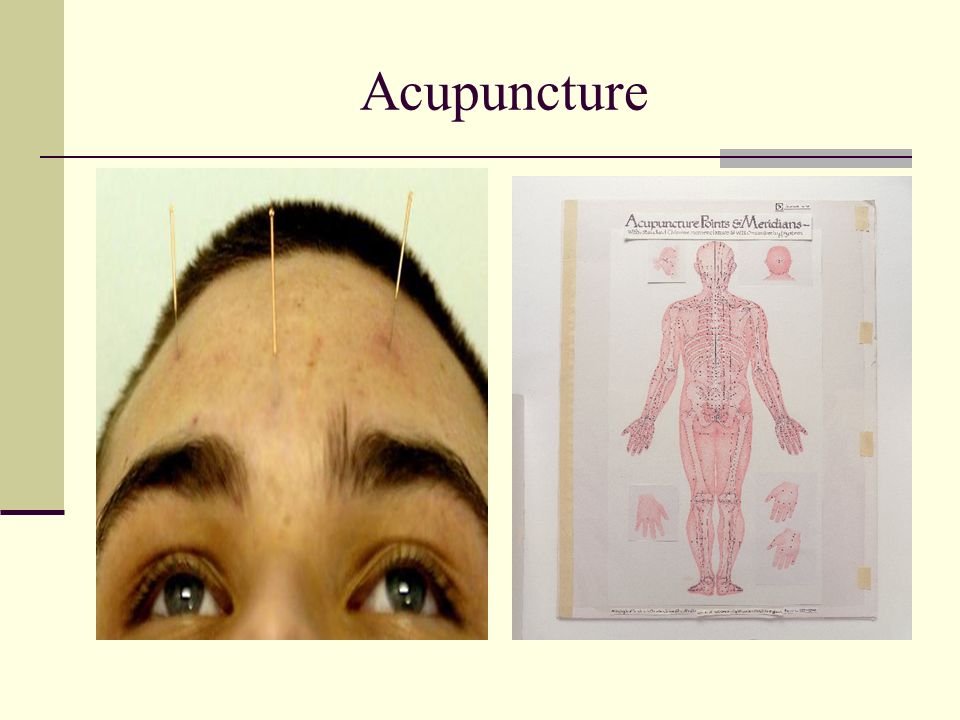 Concord Community Acupuncture