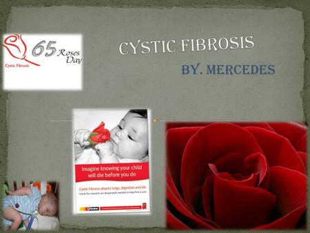 Cystic Fibrosis BY. MERCEDES.