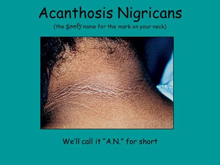 Acanthosis Nigricans (the goofy name for the mark on your neck) We’ll call it “A.N.” for short.