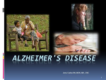 Alzheimer's Disease Jerry Carley RN, MSN, MA, CNE.