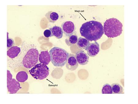 Mast cell tumor in dog Human fibroblast cells - these cells contain numerous different types of proteins which can be visualized with different stains.