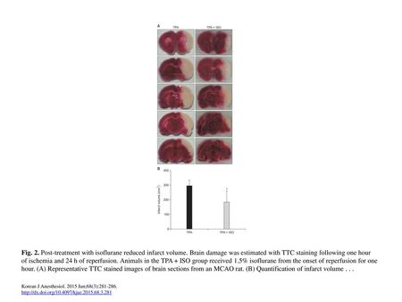 Fig. 2. Post-treatment with isoflurane reduced infarct volume