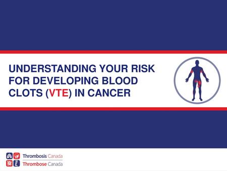 UNDERSTANDING YOUR RISK FOR DEVELOPING BLOOD CLOTS (VTE) IN CANCER