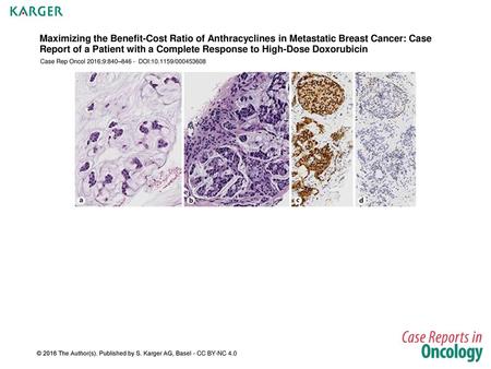 Maximizing the Benefit-Cost Ratio of Anthracyclines in Metastatic Breast Cancer: Case Report of a Patient with a Complete Response to High-Dose Doxorubicin.