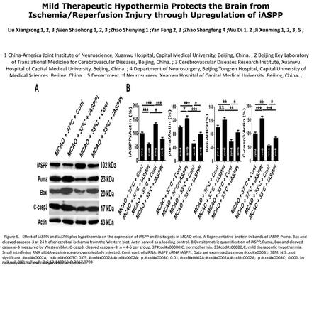 Mild Therapeutic Hypothermia Protects the Brain from Ischemia/Reperfusion Injury through Upregulation of iASPP Liu Xiangrong 1, 2, 3 ;Wen Shaohong 1, 2,