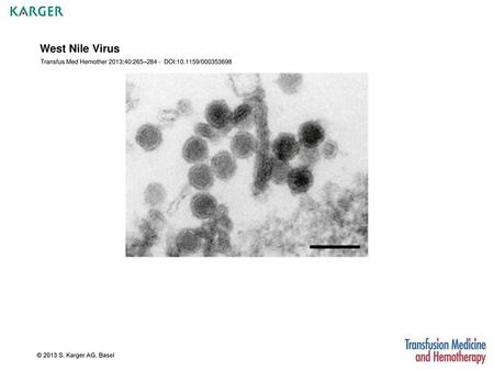 West Nile Virus Transfus Med Hemother 2013;40:265– DOI: /