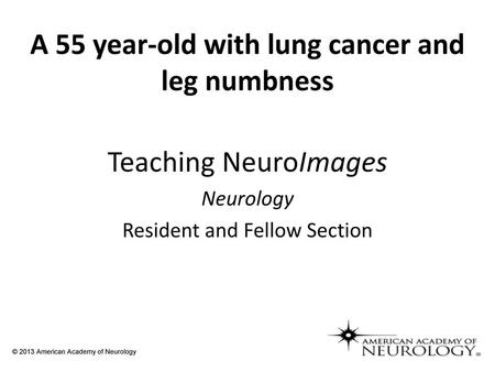 A 55 year-old with lung cancer and leg numbness