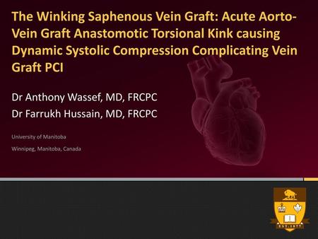 The Winking Saphenous Vein Graft: Acute Aorto-Vein Graft Anastomotic Torsional Kink causing Dynamic Systolic Compression Complicating Vein Graft PCI Dr.
