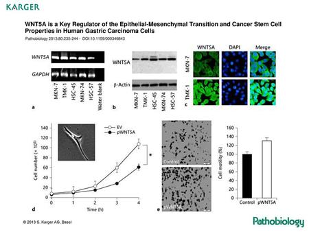 WNT5A is a Key Regulator of the Epithelial-Mesenchymal Transition and Cancer Stem Cell Properties in Human Gastric Carcinoma Cells Pathobiology 2013;80:235-244.