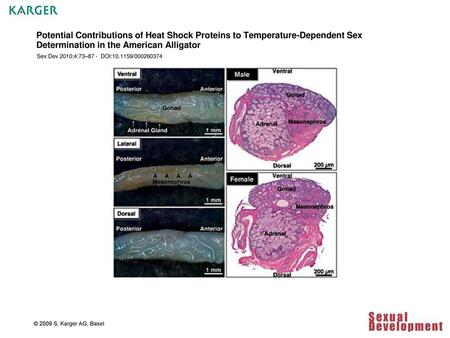 Potential Contributions of Heat Shock Proteins to Temperature-Dependent Sex Determination in the American Alligator Sex Dev 2010;4:73–87 - DOI:10.1159/000260374.