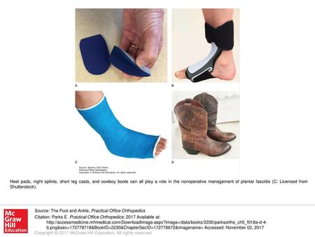 Heel pads, night splints, short leg casts, and cowboy boots can all play a role in the nonoperative management of plantar fasciitis (C: Licensed from Shutterstock).