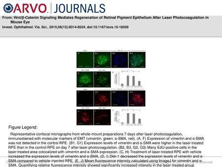 From: Wnt/β-Catenin Signaling Mediates Regeneration of Retinal Pigment Epithelium After Laser Photocoagulation in Mouse Eye Invest. Ophthalmol. Vis. Sci..