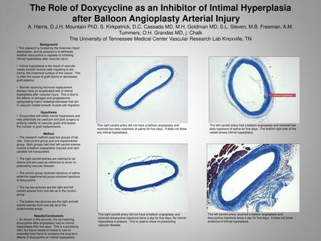 The Role of Doxycycline as an Inhibitor of Intimal Hyperplasia after Balloon Angioplasty Arterial Injury	 A. Harris, D.J.H. Mountain PhD, S. Kirkpatrick,