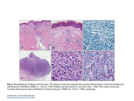 Fig. 2. Histopathology findings of skin lesions