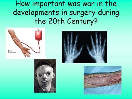 Lesson Objectives To analyse and evaluate the role of WW1 and WW2 in surgical developments in the 20th Century To compare the role of war with other factors.