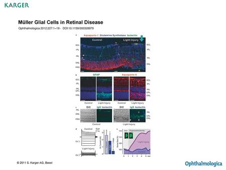 Müller Glial Cells in Retinal Disease