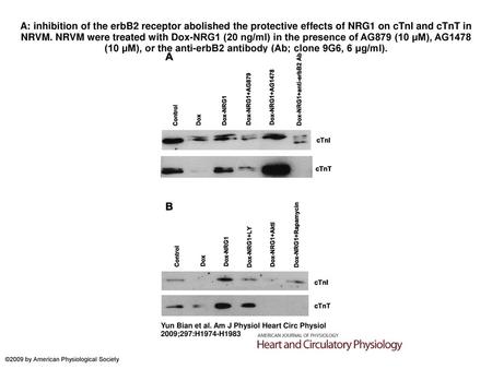 A: inhibition of the erbB2 receptor abolished the protective effects of NRG1 on cTnI and cTnT in NRVM. NRVM were treated with Dox-NRG1 (20 ng/ml) in the.
