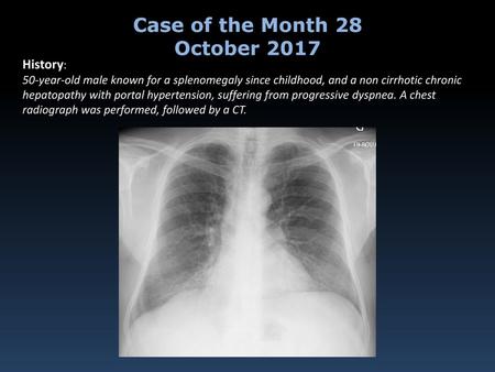 Case of the Month 28 October 2017