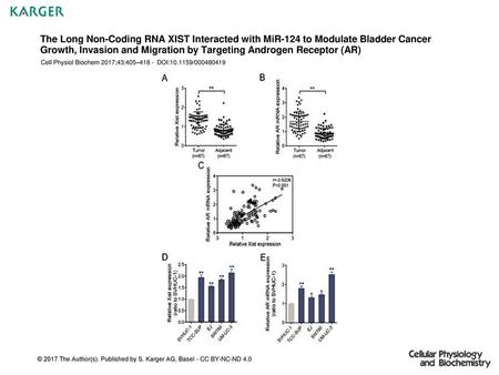 The Long Non-Coding RNA XIST Interacted with MiR-124 to Modulate Bladder Cancer Growth, Invasion and Migration by Targeting Androgen Receptor (AR) Cell.