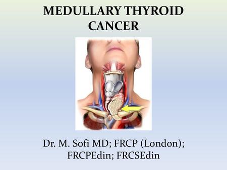 MEDULLARY THYROID CANCER