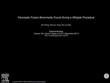 Pancreatic Fusion Abnormality Found During a Whipple Procedure
