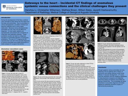 Gateways to the heart – Incidental CT findings of anomalous systemic venous connections and the clinical challenges they present Hanzhou Li, Christopher.
