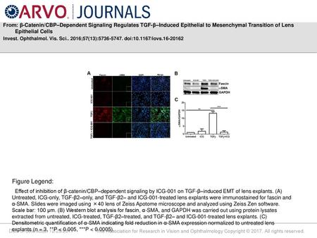 From: β-Catenin/CBP–Dependent Signaling Regulates TGF-β–Induced Epithelial to Mesenchymal Transition of Lens Epithelial Cells Invest. Ophthalmol. Vis.