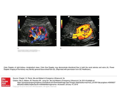 Color Doppler of right kidney—longitudinal views