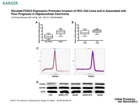 Elevated FOXC2 Expression Promotes Invasion of HCC Cell Lines and is Associated with Poor Prognosis in Hepatocellular Carcinoma Cell Physiol Biochem 2017;44:99–109.