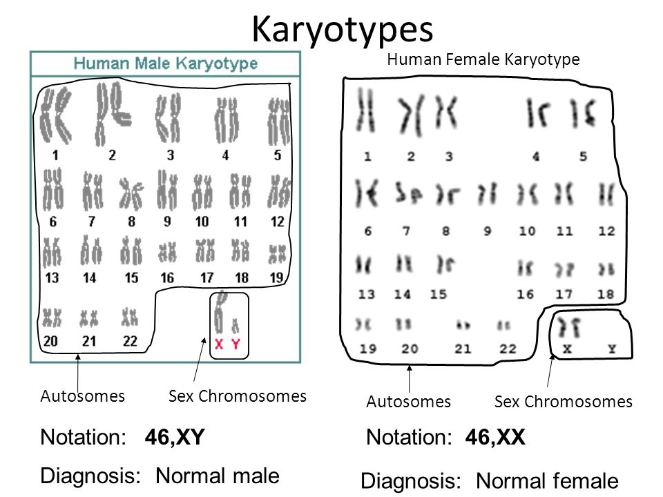 Male Female Chromosomes Xy Xx Foto Bugil Bokep 2017