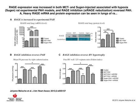 RAGE expression was increased in both MCT- and Sugen-injected associated with hypoxia (Sugen) rat experimental PAH models, and RAGE inhibition (siRAGE.