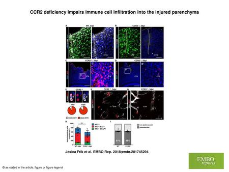 CCR2 deficiency impairs immune cell infiltration into the injured parenchyma CCR2 deficiency impairs immune cell infiltration into the injured parenchyma.
