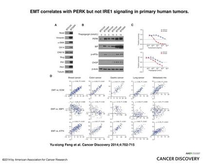 EMT correlates with PERK but not IRE1 signaling in primary human tumors. EMT correlates with PERK but not IRE1 signaling in primary human tumors. A, two.