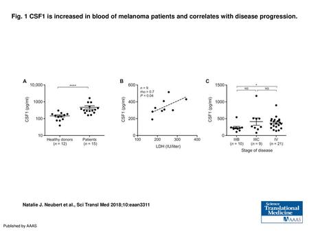 Fig. 1 CSF1 is increased in blood of melanoma patients and correlates with disease progression. CSF1 is increased in blood of melanoma patients and correlates.