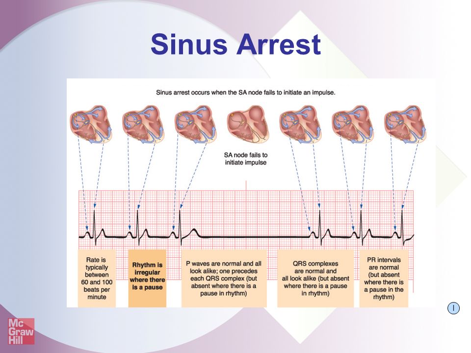 basics anesthesia intensive