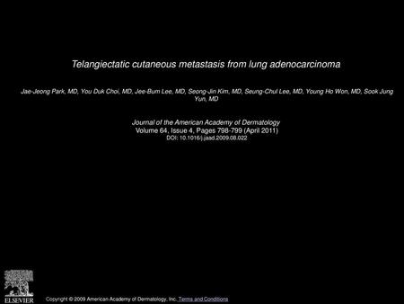 Telangiectatic cutaneous metastasis from lung adenocarcinoma