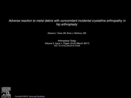 Adverse reaction to metal debris with concomitant incidental crystalline arthropathy in hip arthroplasty  Edward J. Testa, BS, Brian J. McGrory, MD  Arthroplasty.