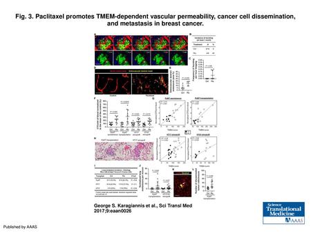 Fig. 3. Paclitaxel promotes TMEM-dependent vascular permeability, cancer cell dissemination, and metastasis in breast cancer. Paclitaxel promotes TMEM-dependent.