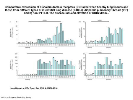 Comparative expression of discoidin domain receptors (DDRs) between healthy lung tissues and those from different types of interstitial lung disease (ILD):