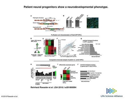 Patient neural progenitors show a neurodevelopmental phenotype.