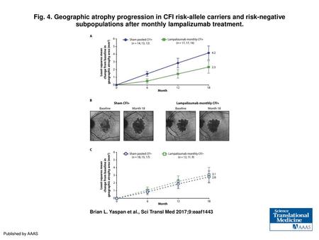 Fig. 4. Geographic atrophy progression in CFI risk-allele carriers and risk-negative subpopulations after monthly lampalizumab treatment. Geographic atrophy.