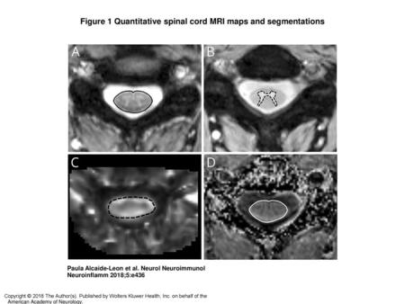 Figure 1 Quantitative spinal cord MRI maps and segmentations