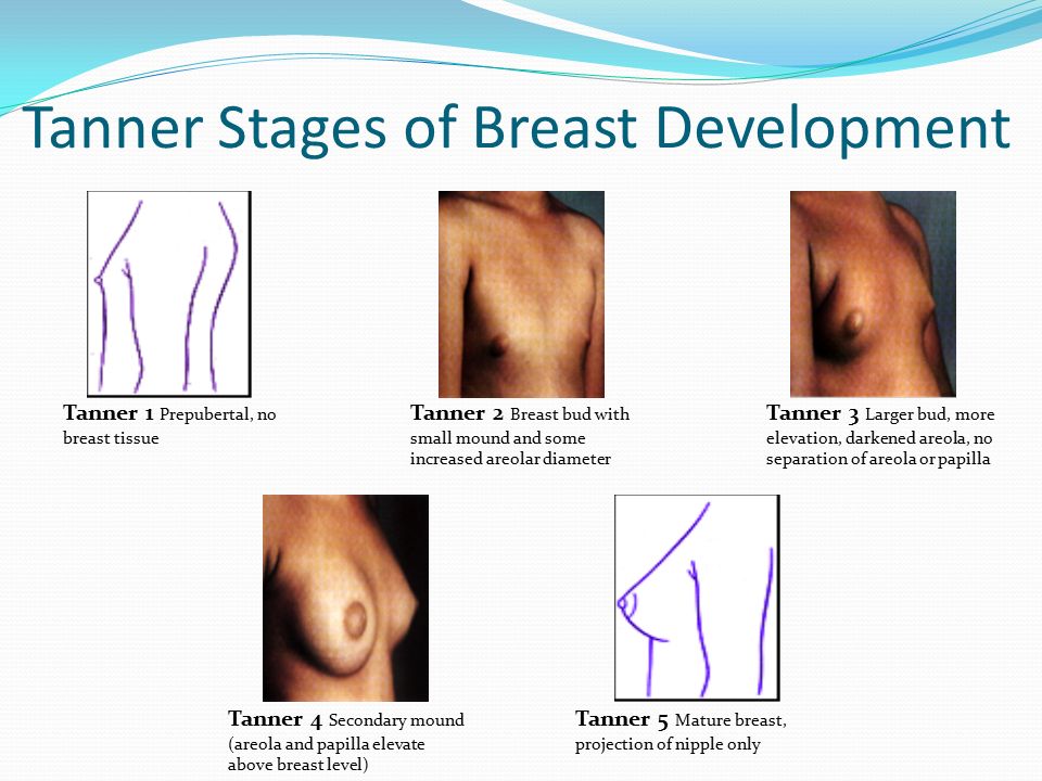 Breast Development Pictures 40