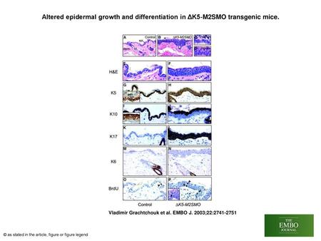 Altered epidermal growth and differentiation in ΔK5‐M2SMO transgenic mice. Altered epidermal growth and differentiation in ΔK5‐M2SMO transgenic mice. Epidermal.